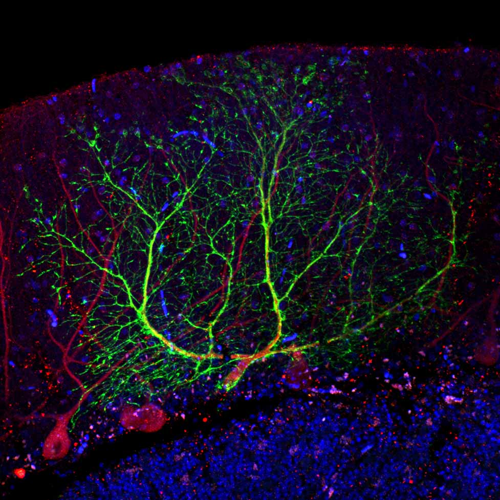 A cerebellar purkinje cell labelled with PSA-NCAM (green) and calbindin (red)